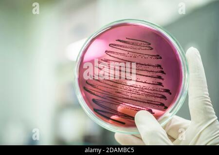 Scienziato che tiene una piastra Petri con una coltura batterica. Foto Stock