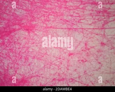 Tessuto areolare umano, micrografia leggera. Foto Stock