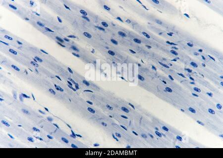 Muscolo cardiaco, micrografia leggera. Foto Stock