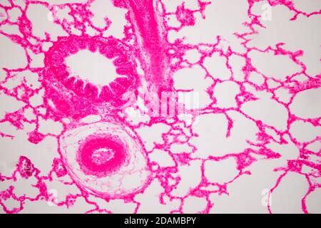 Tessuto polmonare umano, micrografia leggera. I polmoni sono gli organi primari del sistema respiratorio negli esseri umani e in molti altri animali. Foto Stock