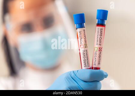 Test positivi e negativi sul nuovo coronavirus in ampules tenuto in mano di un medico. Foto Stock