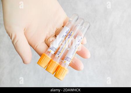 Su una mano guanto ci sono tre provette per il vuoto per il prelievo di sangue per l'analisi. Foto Stock