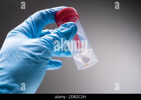 Manuale Medico Con Prelievo Di Campioni Di Feci In Contenitore Di Plastica Foto Stock