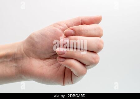 Primo piano di una mano caucasica femminile con unghie naturali non lucidate, cuticola sopravfatta su sfondo bianco, vista dall'alto, spazio di copia. Unghie naturali concep Foto Stock