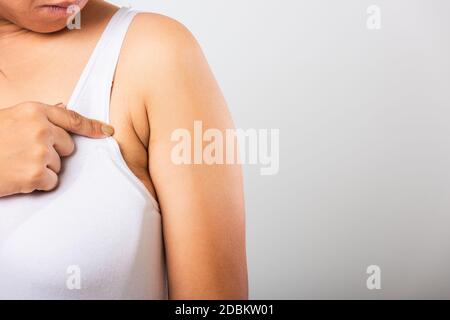 Primo piano di donna asiatica che punta la sua pelle ascella problema ascella grasso ascellare pelle rugosa, problema ascella pelle, studio isolato su bianco backgr Foto Stock