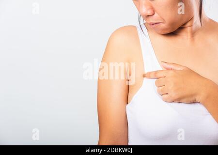 Primo piano di donna asiatica che punta la sua pelle ascella problema ascella grasso ascellare pelle rugosa, problema ascella pelle, studio isolato su bianco backgr Foto Stock