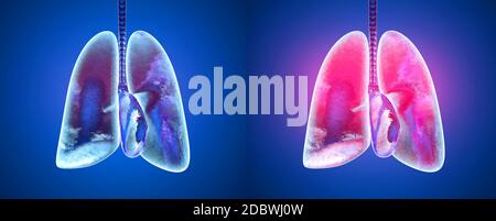 3D reso illustrazione di sani e polmoni infetti in confronto. Foto Stock