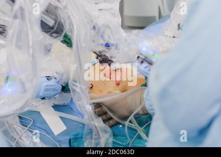 Il processo di esecuzione di un intervento chirurgico utilizzando un moderno sistema chirurgico robotico. Robot medico. Chirurgia robotica minimamente invasiva. Foto Stock