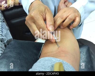 foto orizzontale di closeup maschio asiatico ottenere iniezione sul suo braccio prima della donazione di sangue Foto Stock