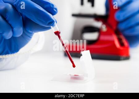 Ricercatore di laboratorio o tecnico medico che preleva un campione di sangue utilizzando un contagocce per pipette da un contenitore, analisi del campione di sangue COVID-19 per pazienti, Coronavirus Foto Stock