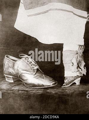 Scarpa normale femminile vs. Piede vincolato, 1918 Foto Stock