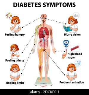 Informazioni sui sintomi del diabete illustrazione infografica Illustrazione Vettoriale