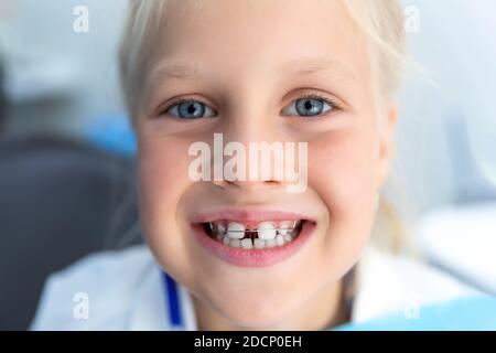 Piccola bionda ragazza felice del capretto all'ufficio del dentista che sorride mostrando diastema i denti di overbite mancano del gap. Bambino durante la visita ortodontista e la cavità orale Foto Stock