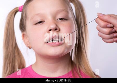 Estrarre un dente di latte con un filo da a. bambina Foto Stock