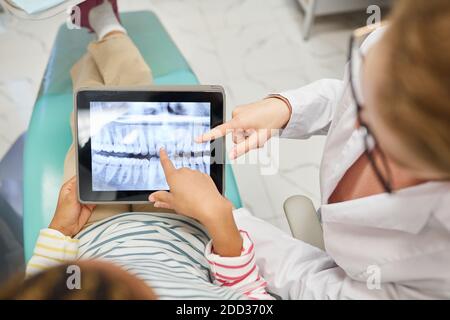 Visualizzazione ad angolo alto di un piccolo paziente che punta al tablet digitale con raggi x dei denti e discuterne con il dentista Foto Stock