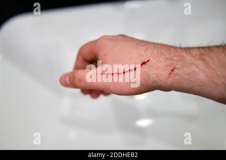 Un graffio con il sangue che corre giù il braccio dell'uomo da un gatto Foto Stock