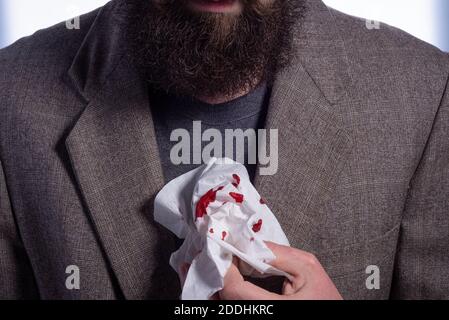 sanguinoso naso che cola, un uomo d'affari con una barba che tiene in mano un fazzoletto di sangue. Primo piano concetto di medicina e assistenza sanitaria. Uomo paura lo Foto Stock