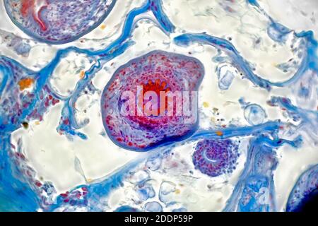 fotomicrografo a campo chiaro, parasite di tapeworme cane deatail, encysted. Cisti di idatide del taperino nel cane, TS. Foto Stock