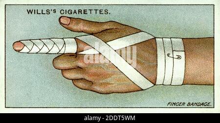 Carte di sigarette antiche. Sigarette di Wills (serie di pronto soccorso ). Fasciatura per le dita. Inghilterra. 1913 Foto Stock