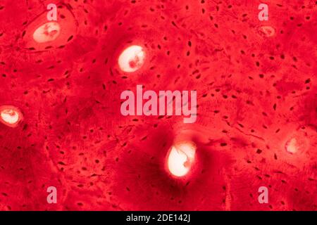 Tessuto osseo compatto umano, micrografia leggera Foto Stock