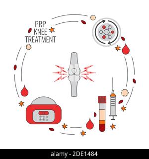 Trattamento al plasma ricco di piastrine, illustrazione Foto Stock