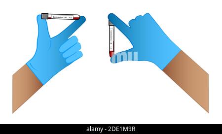 i medici mano in un guanto contiene provette con test del coronavirus. Risultato positivo e negativo. Vettore isolato su sfondo bianco Illustrazione Vettoriale