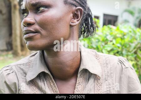 Irine Akinyi, 28 anni, vittima di avvelenamento da piombo nel villaggio di Uwino Uhuru di Changamwe visto dopo un'intervista con la stampa. Soffre di problemi renali e tiroidei come risultato dell'esposizione all'avvelenamento da piombo da una società di fusione di batterie al piombo nel suo quartiere. L'azienda è stata finora chiusa, ma i danni lasciati sono stati mortali. In una sentenza Landmark all'inizio di quest'anno, il governo e i due investitori privati sono stati ordinati di pagare alle vittime un ksh 1.3 miliardi equivalente a 12 milioni di dollari come risarcimento, una questione che il governo attraverso il procuratore generale ha appello Foto Stock