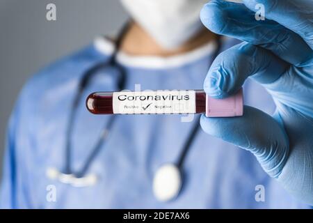 Il medico sta mostrando un campione di analisi del sangue positivo per il coronavirus con uno stetoscopio, un abbigliamento protettivo e una maschera medica. Foto Stock