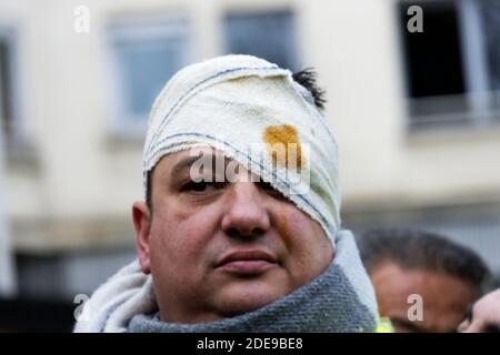 Il protettrice di Yellow Vests indossa un bendaggio sulla testa e sugli occhi raffigurante il leader francese del movimento Gilet Jaune Jerome Rodrigues con un colpo di ferita agli occhi della polizia francese , ai margini di una protesta contro la violenza della polizia nei confronti dei partecipanti delle manifestazioni degli ultimi tre mesi in Francia, Come i manifestanti giubbotti gialli (Gilets Jaunes) scendono in piazza per il 12 ° Sabato consecutivo. Il movimento "giallino" (Gilets Jaunes) ha chiesto una protesta pacifica contro la violenza della polizia nei confronti dei partecipanti alle manifestazioni degli ultimi tre mesi in Francia e il divieto di utilizzare armi di polizia in rivolta Foto Stock