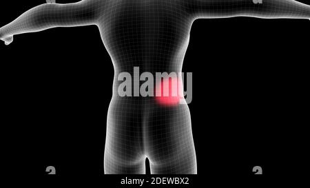 illustrazione 3d di un ologramma a raggi x maschile che mostra l'area del dolore sul retro Foto Stock