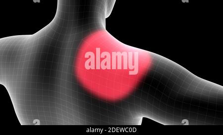 illustrazione 3d di un ologramma a raggi x maschile che mostra l'area del dolore sul retro Foto Stock