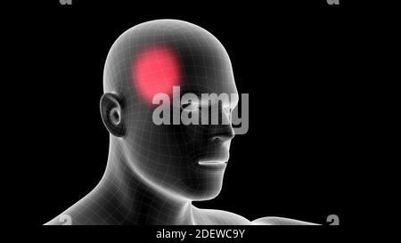 illustrazione 3d di un ologramma a raggi x maschile che mostra l'area del dolore sull'area della testa Foto Stock