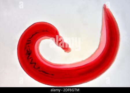 Schistosomiasi Foto Stock Alamy