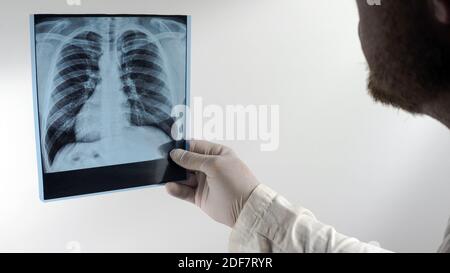 Radiografia dei polmoni umani in primo piano, immagine dei polmoni nelle mani di un medico su sfondo bianco. Foto Stock