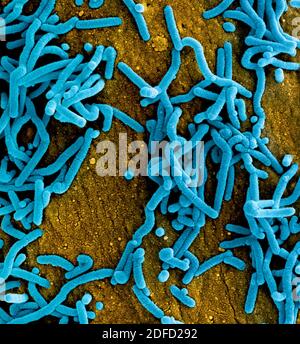 Micrografia elettronica a scansione colorata di particelle di virus Marburg (blu) che si accodano e si attaccano alla superficie di cellule di vero E6 infette (arancione). Foto Stock
