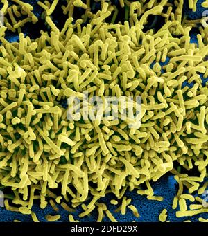 Micrografia elettronica a scansione colorata di particelle di virus Marburg (giallo) che si accodano e si attaccano alla superficie di cellule vero E6 infette (blu). Foto Stock