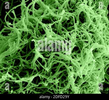 Micrografia elettronica a scansione colorata di particelle filamentose del virus Ebola che germogliano da una cellula VERO E6 cronicamente infetta (ingrandimento 35.000 volte). Foto Stock