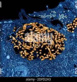 Micrografia elettronica a trasmissione colorata dei nucleocapsidi del virus Ebola (piccoli cerchi arancioni) e particelle di virus (forme filamentose arancioni più grandi) w Foto Stock