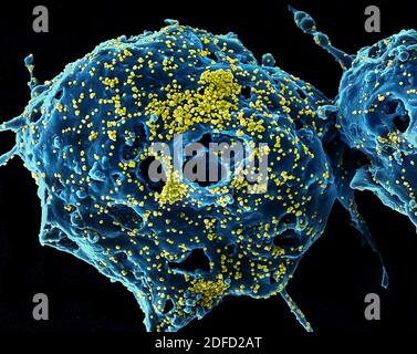 Micrografia elettronica a scansione colorata del virus della sindrome respiratoria del Medio Oriente Particelle (gialle) attaccate alla superficie di un vero infetto E6 cel Foto Stock