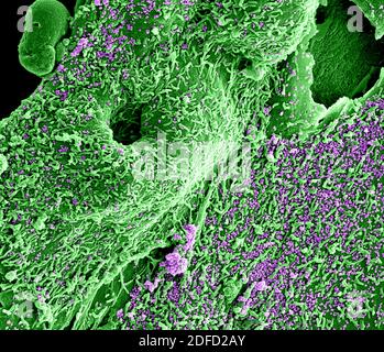 Micrografia elettronica a scansione colorata del virus della sindrome respiratoria del Medio Oriente Particelle (viola) attaccate alla superficie di un vero infetto E6 cel Foto Stock