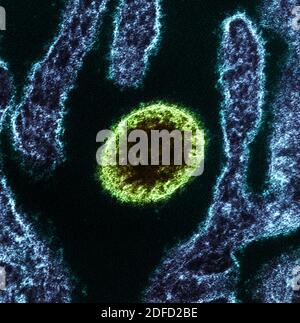 Micrografia elettronica a trasmissione colorata di una particella di virus Nipah extracellulare matura (verde) vicino alla periferia di una cellula vera infetta (blu). Foto Stock