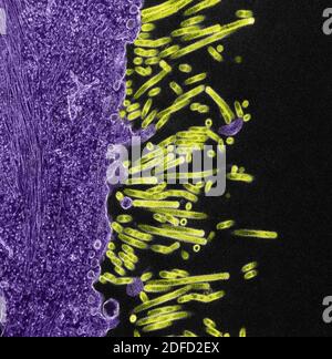 Micrografia elettronica a trasmissione colorata di SW31 (ceppo suina) particelle di virus dell'influenza (verdi) attaccate e provenienti dal Superficie di un MDCK Foto Stock