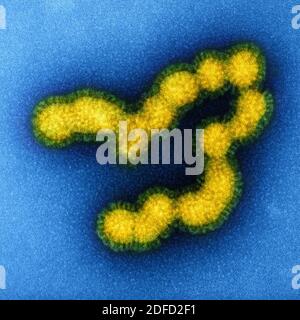Micrografia elettronica a trasmissione colorata di particelle di virus influenzali SW31 (ceppo suina) macchiate negativamente. Credito: NIAID. Foto Stock