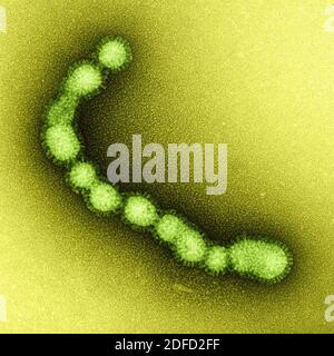 Micrografia elettronica a trasmissione colorata di particelle di virus influenzali SW31 (ceppo suina) macchiate negativamente. Credito: NIAID. Foto Stock