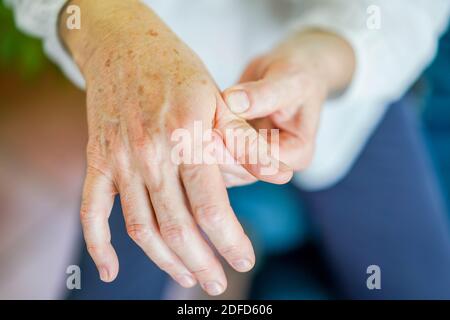 Senior donna che soffre di un dolore articolare in mano. Foto Stock