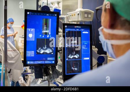 Trattamento del cancro prostatico con ultrasuoni focali ad alta intensità (Focal-one), ospedale di Bordeaux, Francia. Foto Stock