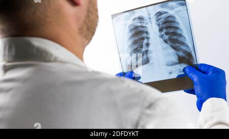 Radiografia dei polmoni umani in primo piano, immagine dei polmoni nelle mani di un medico su sfondo bianco. Foto Stock