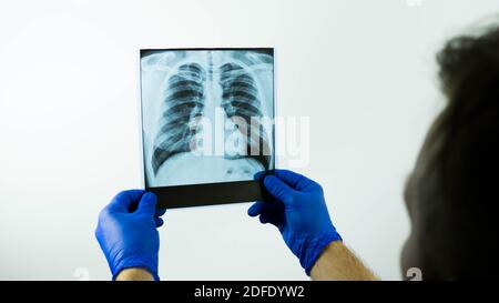Raggi X dei polmoni umani nelle mani di un medico, la diagnosi di polmonite con raggi X. Foto Stock