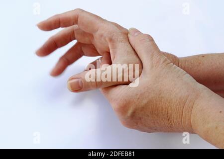 Le mani di una donna con malattia di Parkinson tremano molto fortemente Foto Stock
