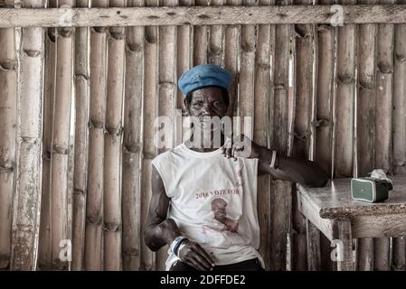 Un uomo africano con un vecchio braccio ferimento seduto in un bar, Keta Ghana Africa occidentale 2020 novembre 12 Foto Stock